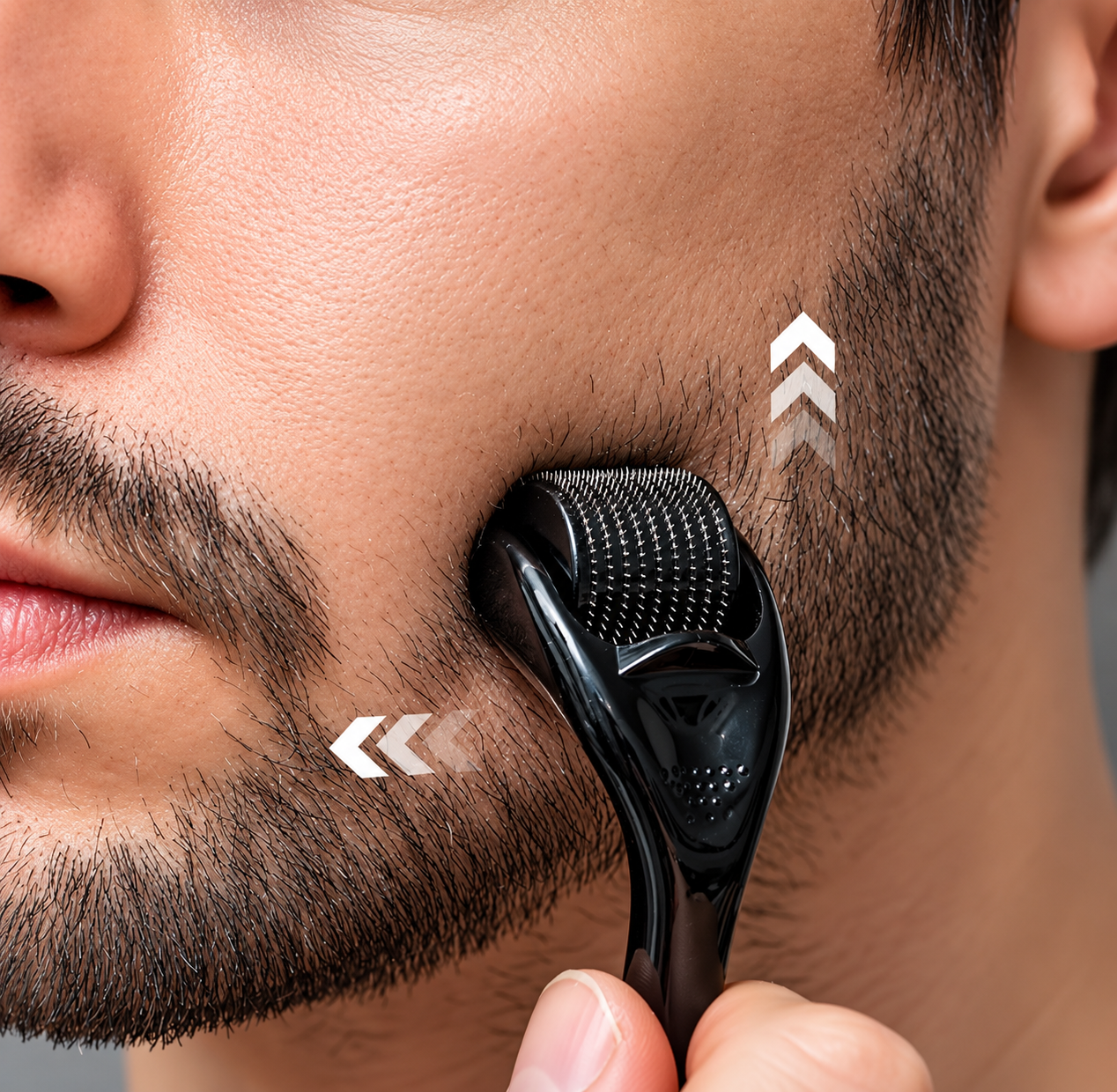 Microneedling Derma Roller - Image 4